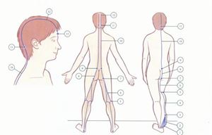 颈项疼痛与颈丛关系,颈项强痛不