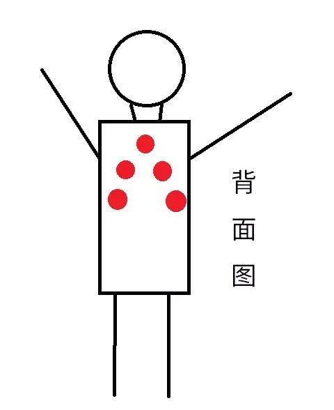 三伏贴烫伤瘙痒怎么办,贴三伏贴穴位有灼烧感