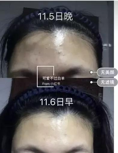 这些护肤成分不要混着用,护肤成分没选对会烂脸