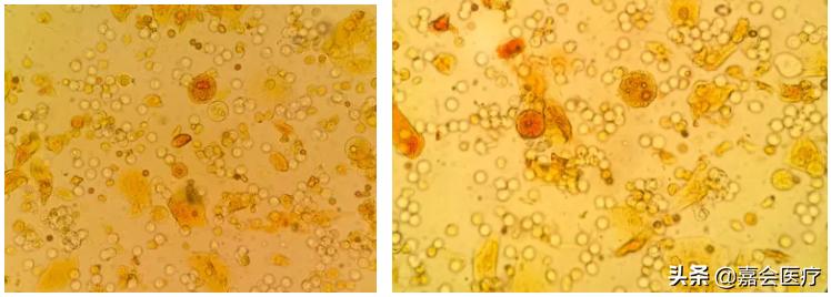 尿液突然变红、变绿?注意这些常见药会改变尿液颜色