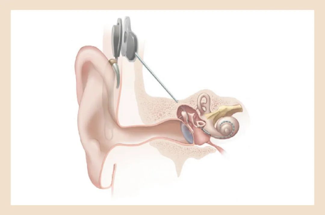 听觉世界的医者、雅士与侠客-同仁医院耳科主任李永新