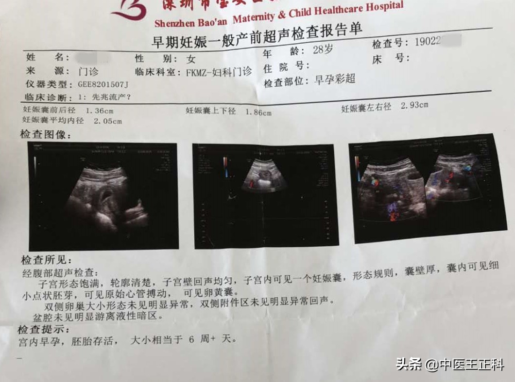 深圳私企女职工怀孕,广东深圳女子怀孕