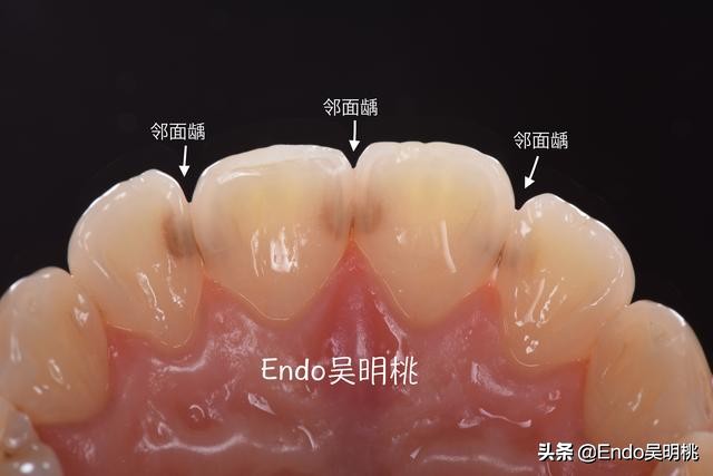 雾里看花墙布,雾里看花找枯枝