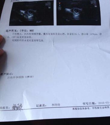 孕早期b超报告单都有什么,孕早期b超查不出来腹疼流血稍多