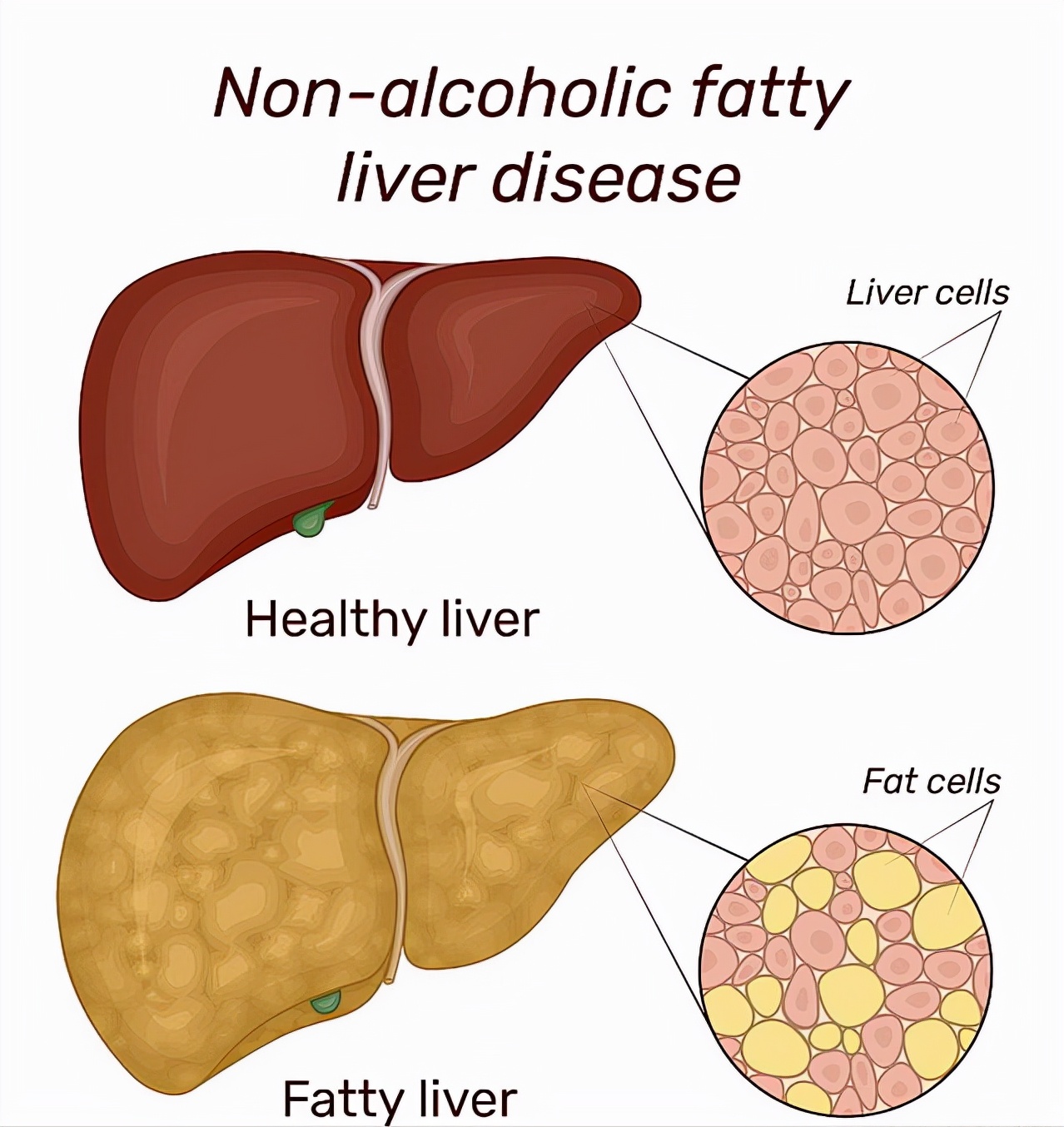肝胆有哪些临床操作,肝胆体检怎么查