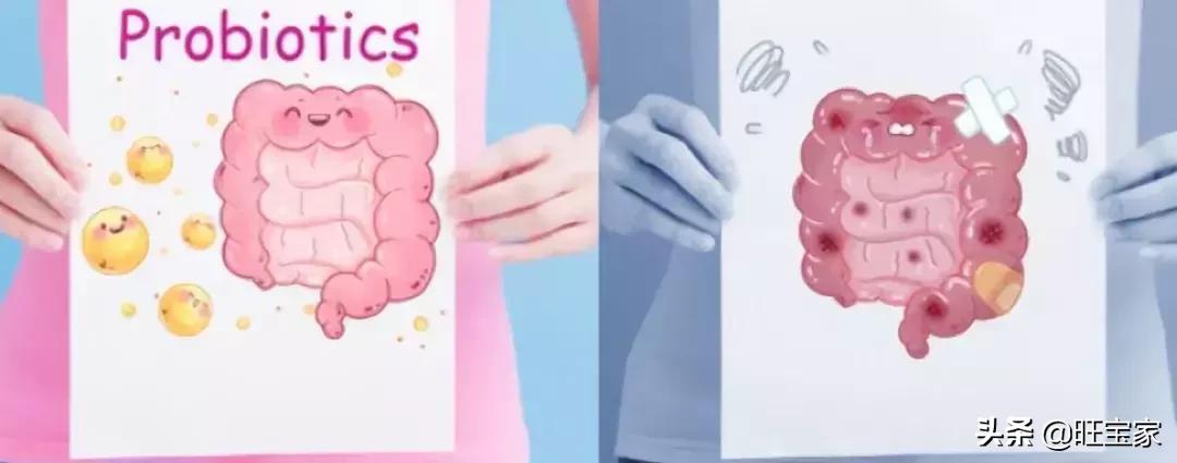 宝宝粑粑里有黑色条状物,宝宝粑粑里有小黑块