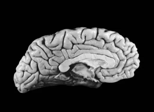 爱因斯坦大脑和平常人大脑对比,爱因斯坦大脑与正常人大脑的区别