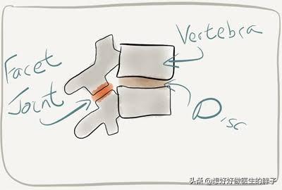 腰痛要休息多久才能运动,腰痛患者都有哪些运动不推荐做