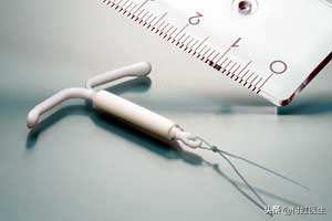 宫内避孕环真的可以避孕吗,又能避孕又能调经的药