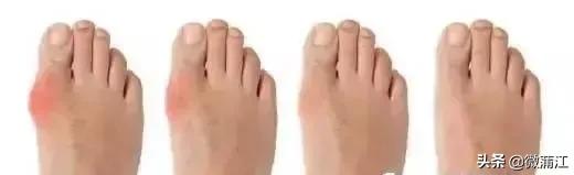 超声新技术医学影像,超声医学检查技术