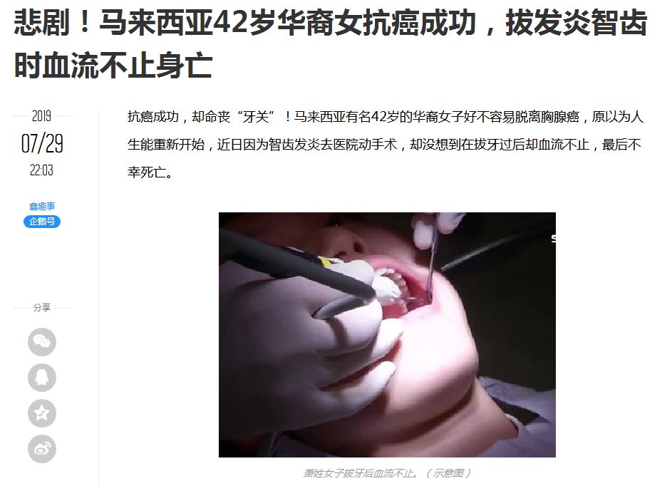 拔智齿是怎么算收费的,拔智齿是按智齿个数收费吗