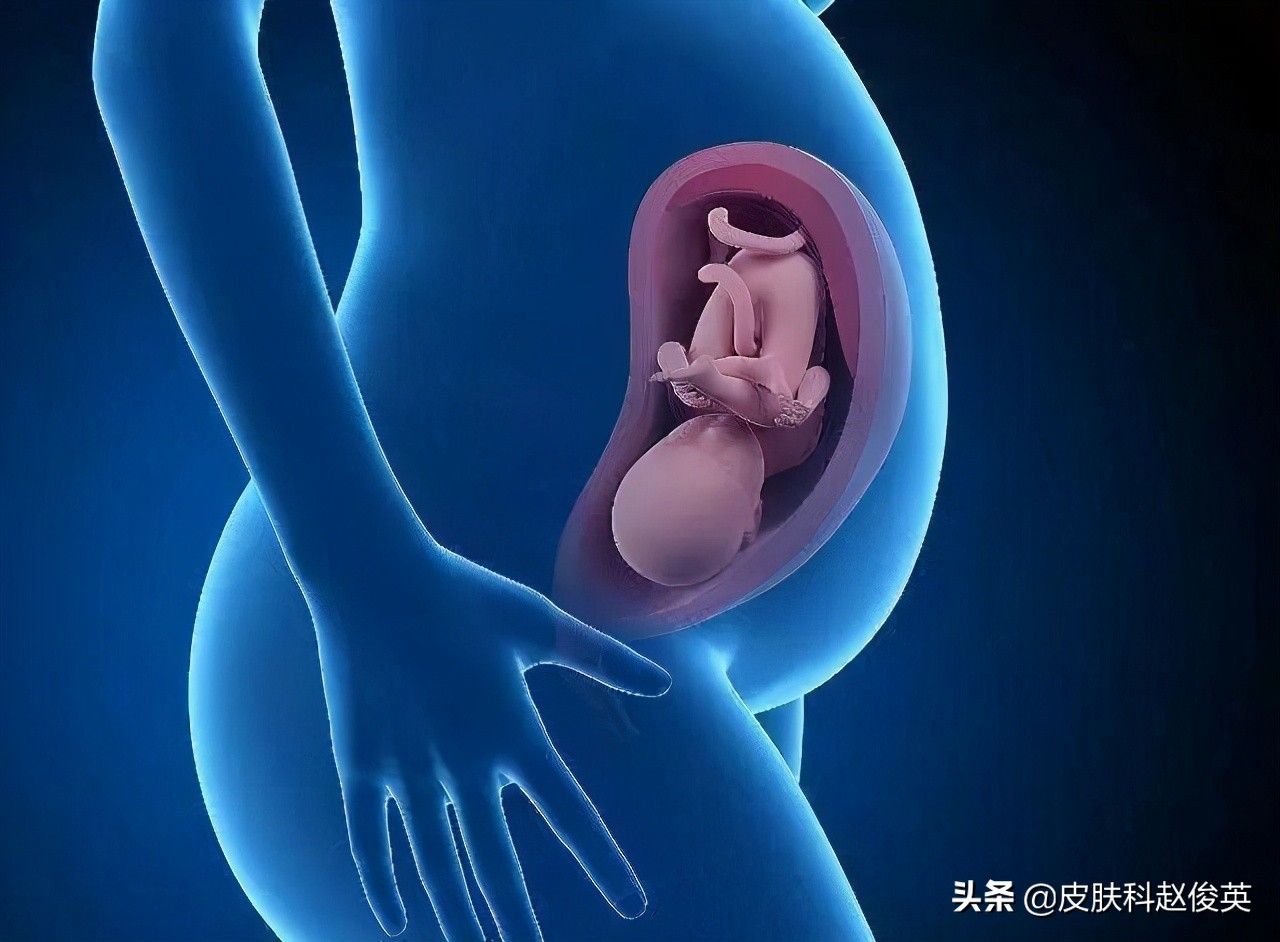 孕早期口内生疮咋办,哺乳期乳房生疮是什么症状