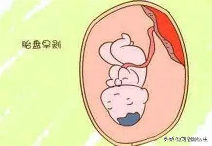 免疫系统造成的孕早期出血怎么办,免疫系统疾病孕期