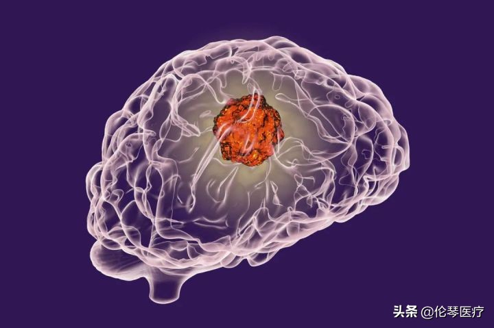 2022年恶性肿瘤筛查与预防指南,常见恶性肿瘤的预防和筛检