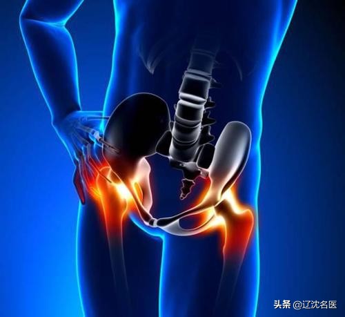 沈阳医大一院换股骨头手术费,沈阳医大一院骨科膝关节置换