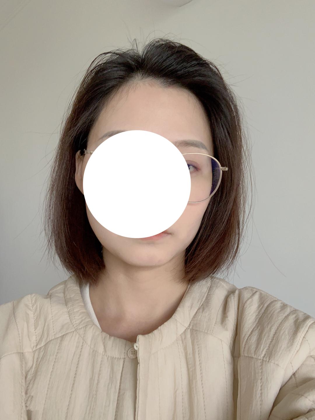 头型尖怎么整容,头型太丑什么发型能补救