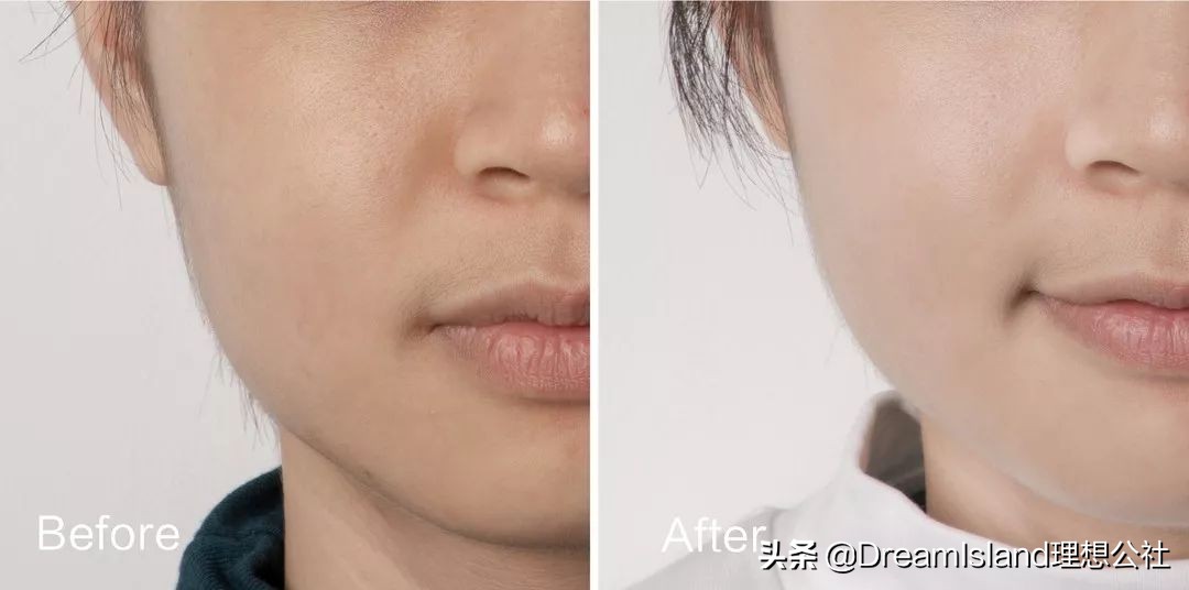 皮肤太白会不会有问题,皮肤太白涂什么好