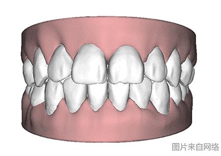 隐形矫正精细调整的流程,做隐形矫正的方案费不能退吗