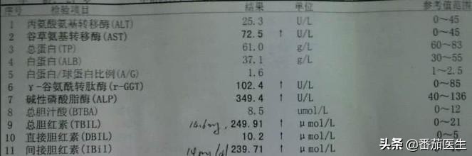 乙肝患者如何判断乙肝病情轻重,乙肝病毒10的几次方代表病情轻重