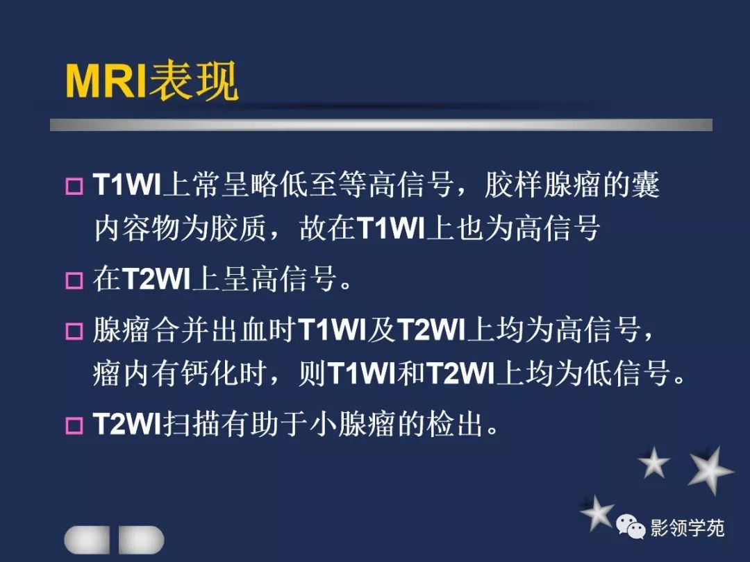 腮腺疾病影像学诊断,腮腺肿块影像诊断