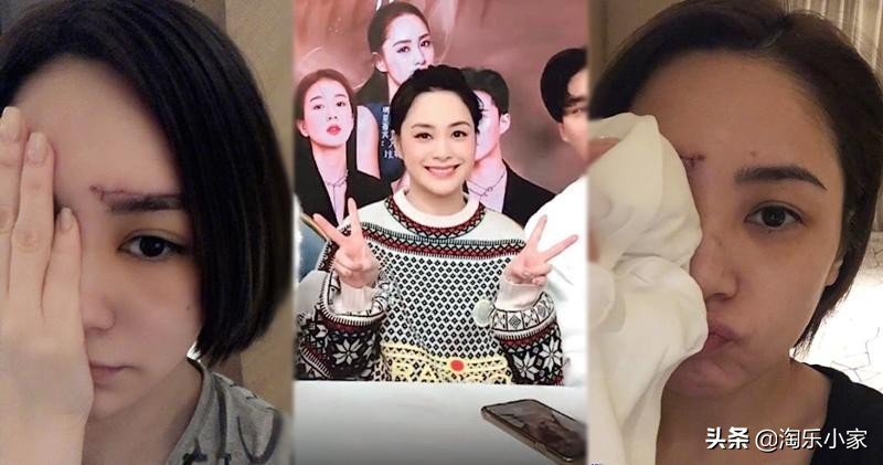 阿娇钟欣潼现状,钟欣潼阿娇近日新闻