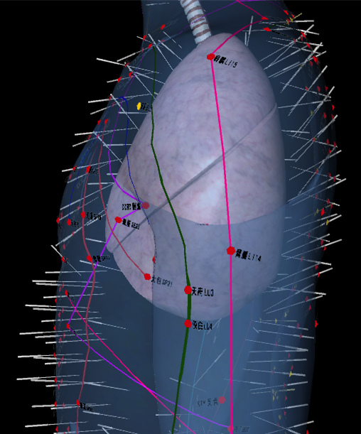 针灸肩井穴一般多深会导致气胸,针灸气胸紧急处理