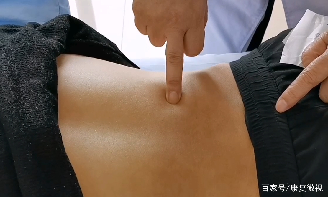 腰腿痛的问诊方法,腰腿疼诊断