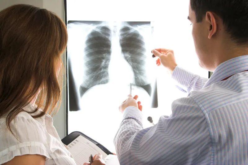 预防结核病最有效措施免疫学,干细胞治疗结核病