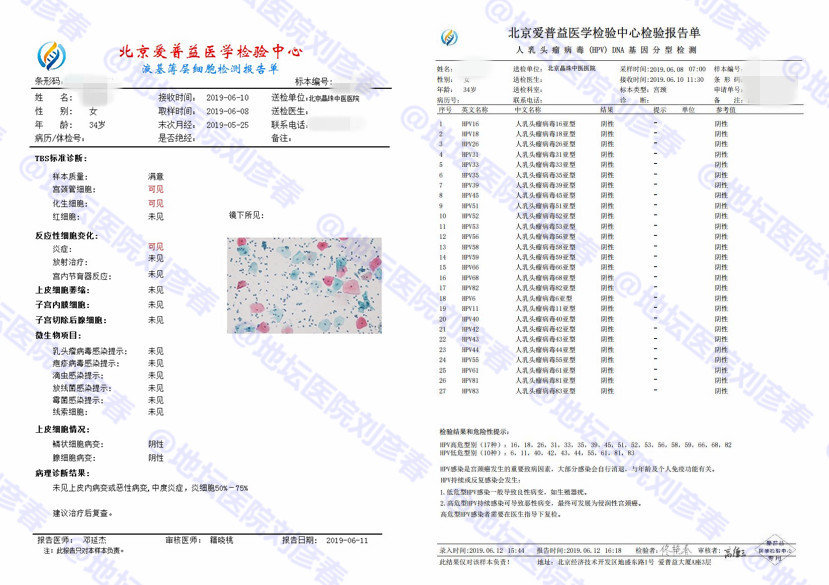 干扰素治非典型鳞状细胞吗,hpv低级病变用干扰素