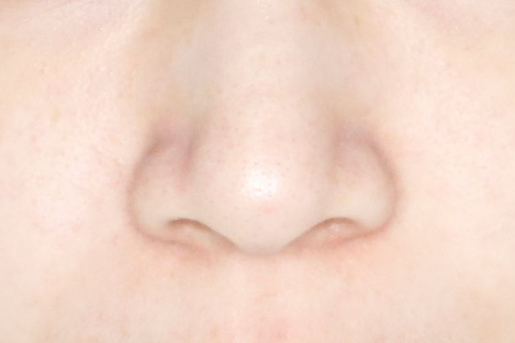 脸上皮肤需要定期做深度清洁吗,皮肤不好去医院检查什么