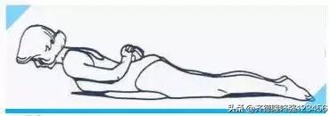 腰痛宁胶囊治腰间盘突出效果怎样,腰间盘突出压迫腿疼正确锻炼视频