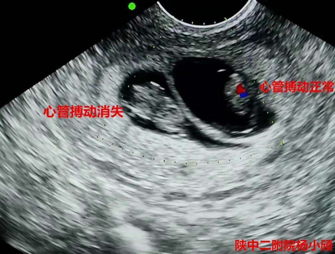 陕西中医药大学附属医院生殖科,中医药大学附属第二医院生殖中心
