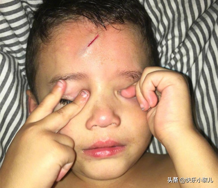 萌娃不小心撞到脑袋摔一跤,萌娃不小心撞到脑袋摔了一跤