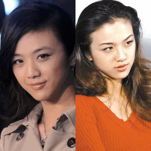 塌鼻梁鼻头大整容会有副作用吗,塌鼻梁凸嘴高颧骨整容