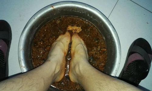 什么是脚气得了脚气怎么快速消除,脚气和真正的脚气病有什么区别