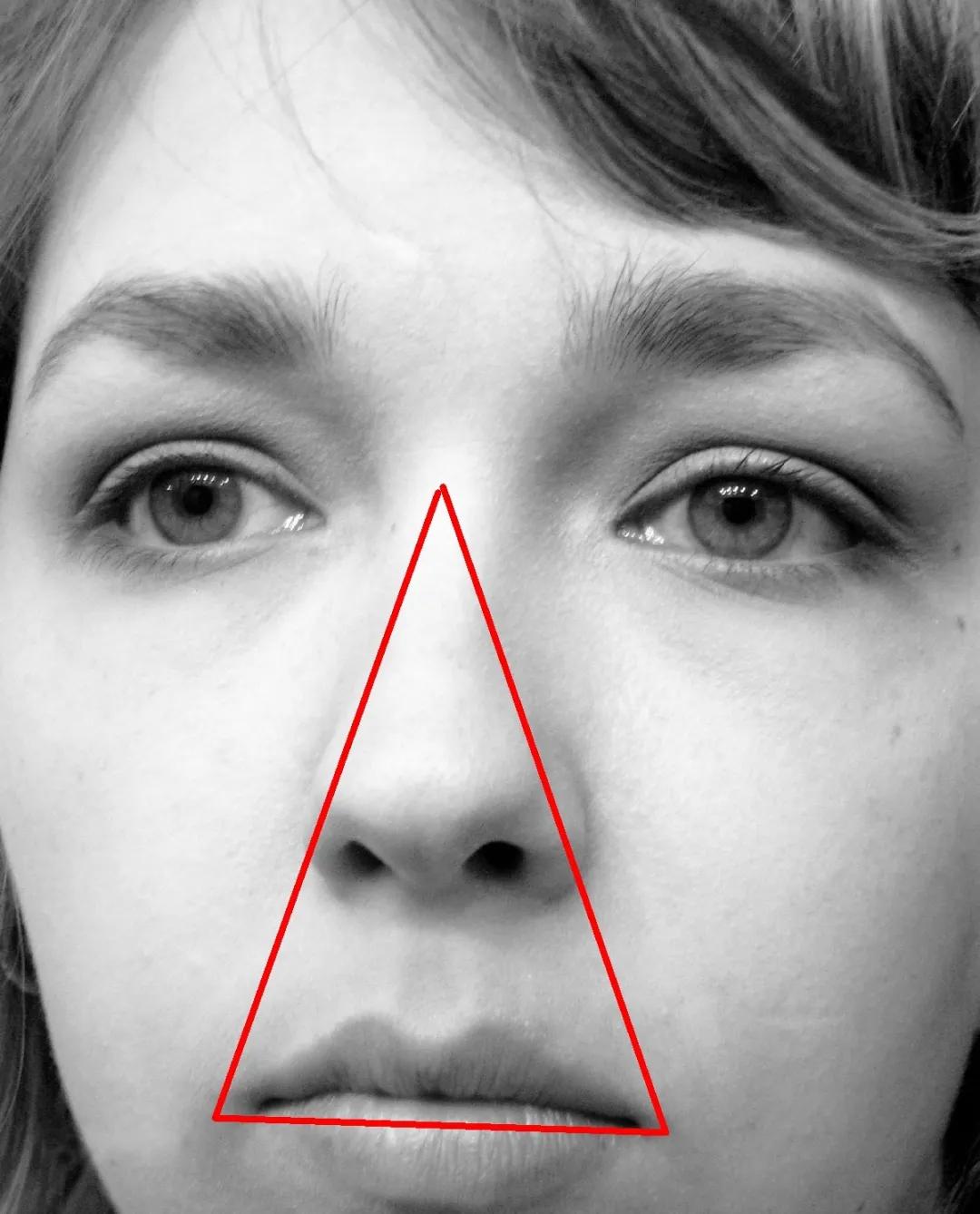 鼻孔会越挖越大吗？挖鼻孔还可能会住进ICU