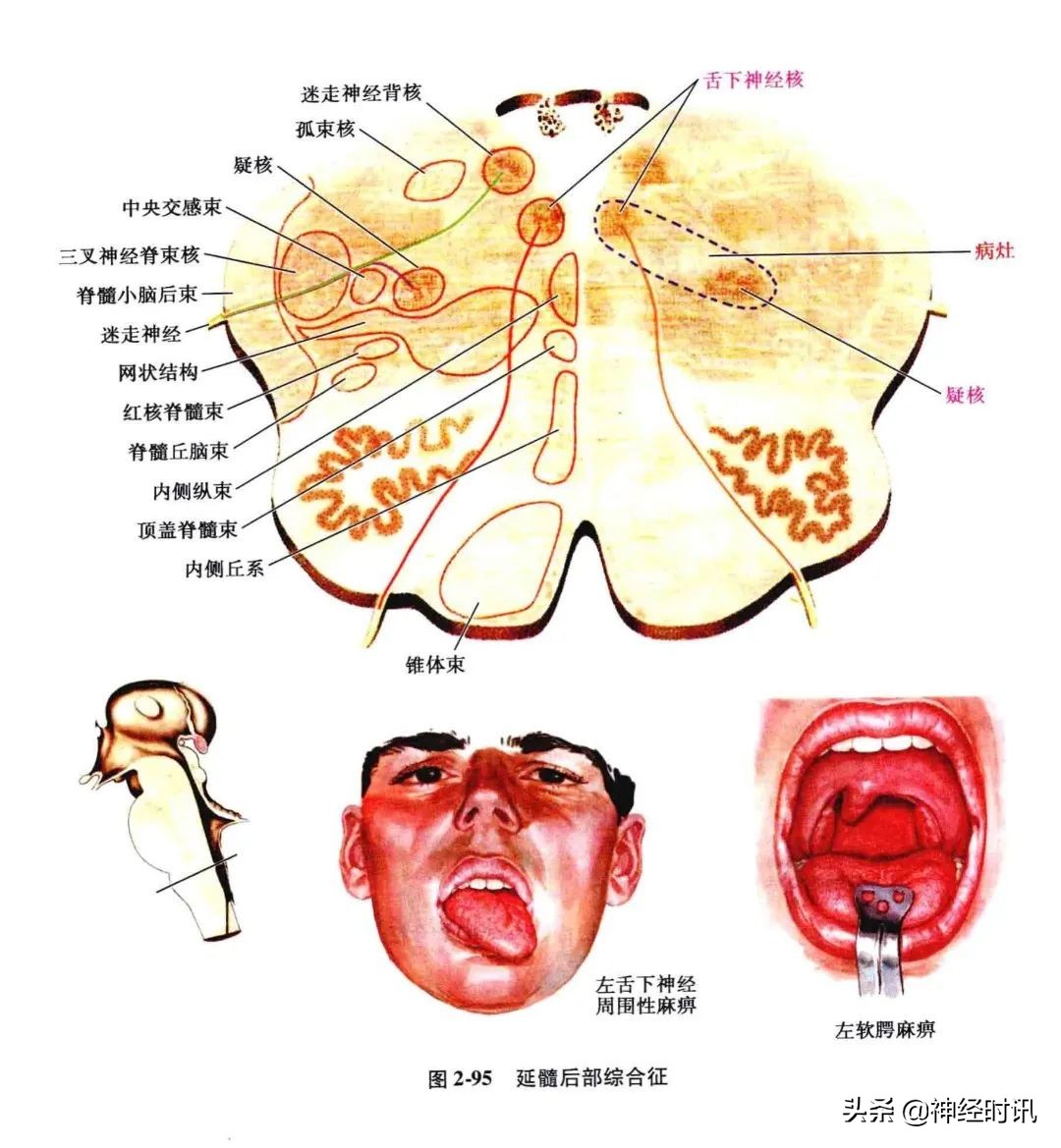 脑干解剖,脑干神经解剖