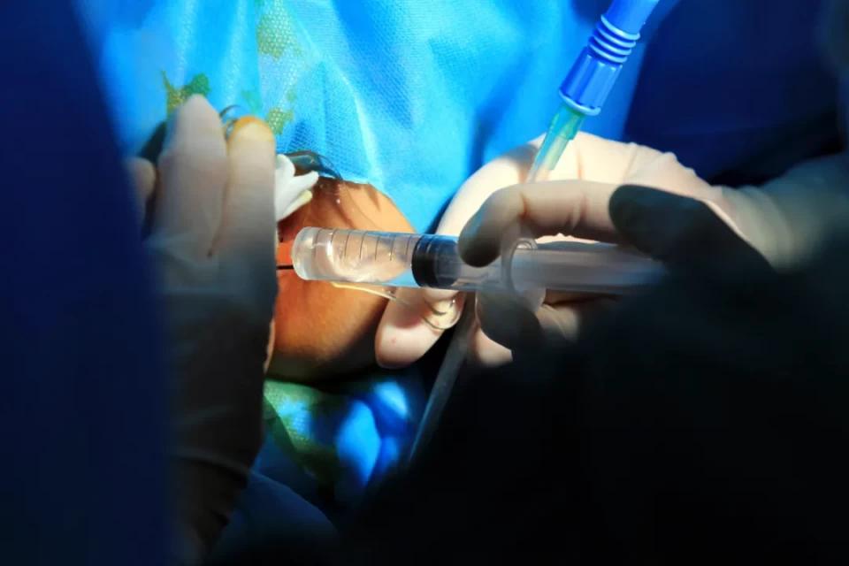 别不好意思了！小心“菊花”变“肉球”