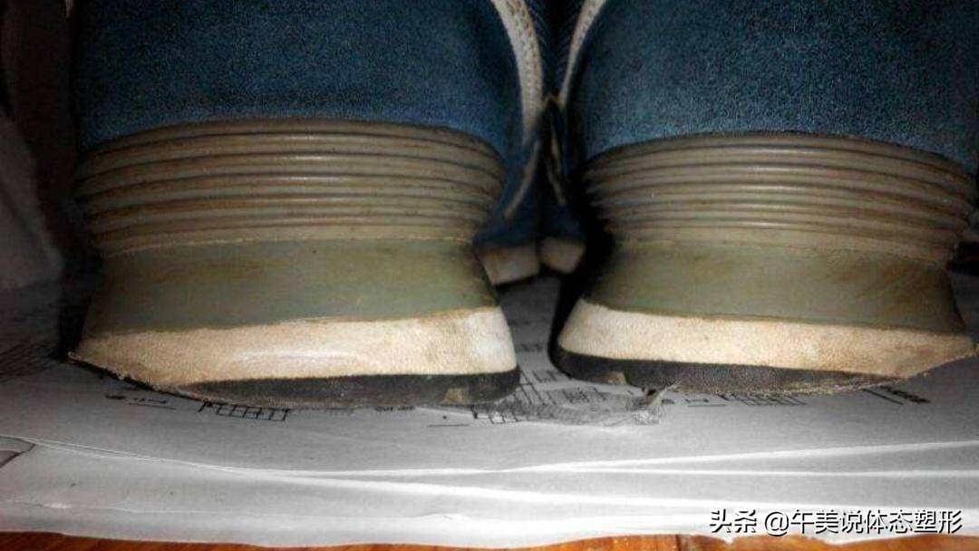 膝盖下o型腿怎么矫正,膝盖腿弯疼最好治疗方法