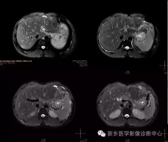 这些部位的黑色素瘤，您会诊断吗？