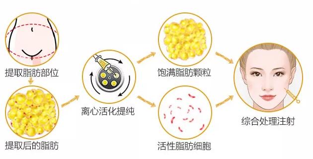 除皱方法大揭秘顺利抚平皱纹,除皱抗皱有什么好的方法