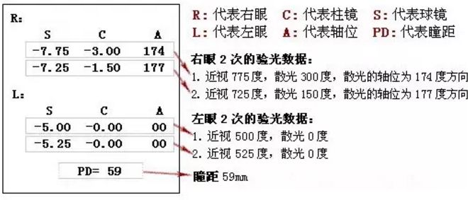 眼科学基础视力检查的方法,如何看懂眼科验光数值