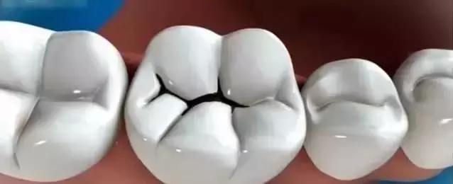 看牙的时候特别疼有什么方法不痛,去医院看完牙怎么比不看还疼