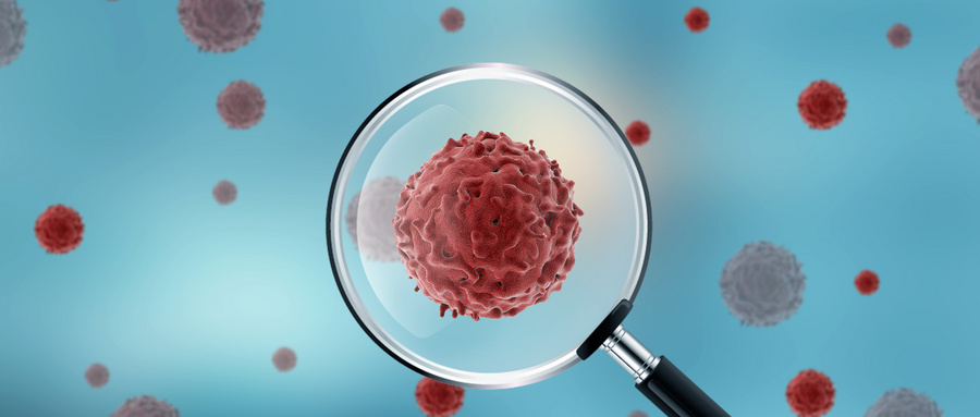 当心!这个术后并发症可能会夺走肿瘤患者的生命