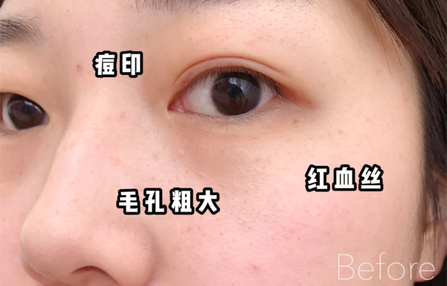 绿宝瓶pro是什么,绿宝瓶pro怎么买划算