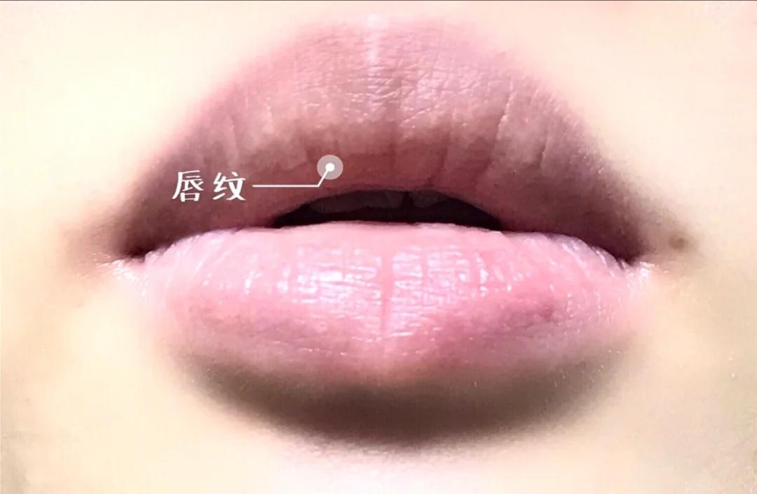 嘴唇好丑怎么变好看,嘴唇为何会越变越难看