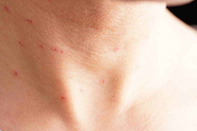 小点阵激光与大点阵激光,光子点阵跟点阵激光有什么区别