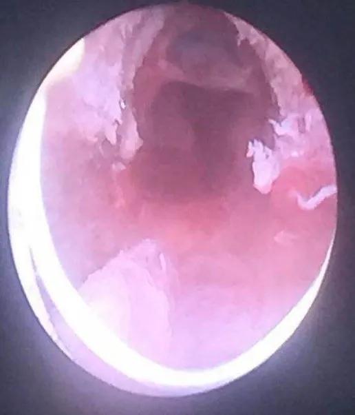 名医札记,名医札记张家华