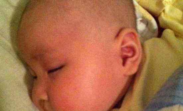 宝宝耳朵小是没福气吗,宝宝耳朵一边塌一边不塌