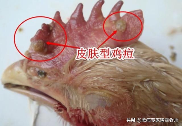 鸡痘怎么治才能彻底好,治鸡痘最好的方法